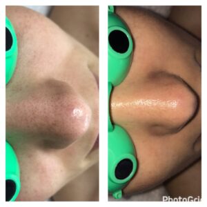 A before and after picture of the nose with green eyes.