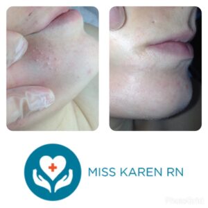 A woman 's face and hands with the logo for miss karen rn.